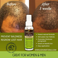 Hair Growth Booster (For Thinning or Balding Hair)